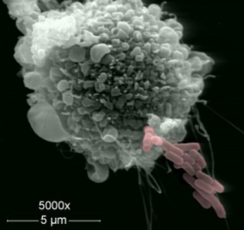 Therapie von Metastasen mit Hilfe von Mikroorganismen