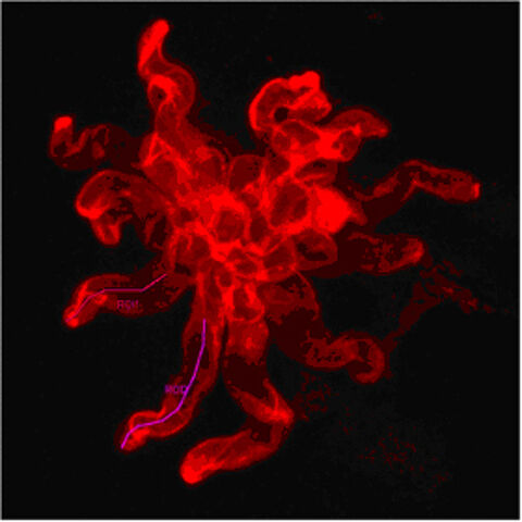 Hyphen von A. fumigatus Hyphen von A. fumigatus