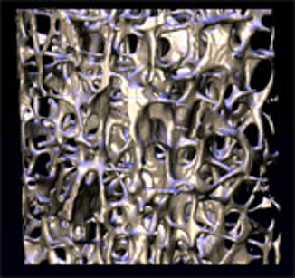 für Tissue Engineering geometrieoptimierte Custom-Implantate für Tissue Engineering geometrieoptimierte Custom-Implantate