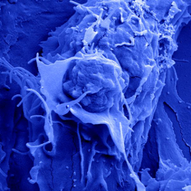 Neue Resistenzen von Bakterien und Viren